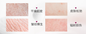 SingulaDerm圣歌蘭，探索科學抗衰老的秘密